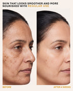 Eldelie Skin Repair Cream (Coenzyme Q10 + Vitamin E)