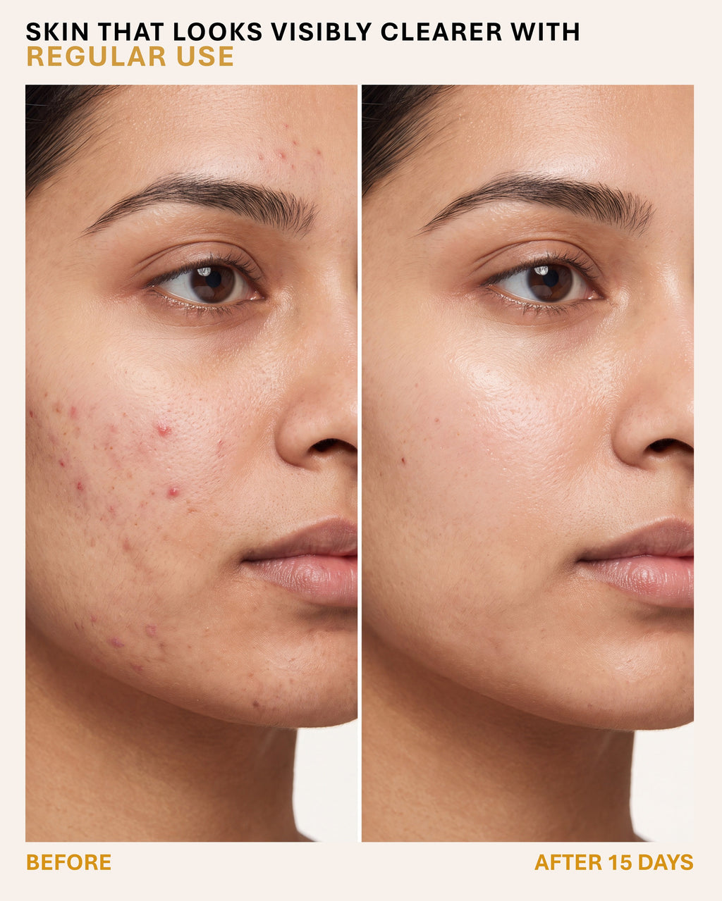 Eldelie 4% Glycolic Acid Clarifying Toner