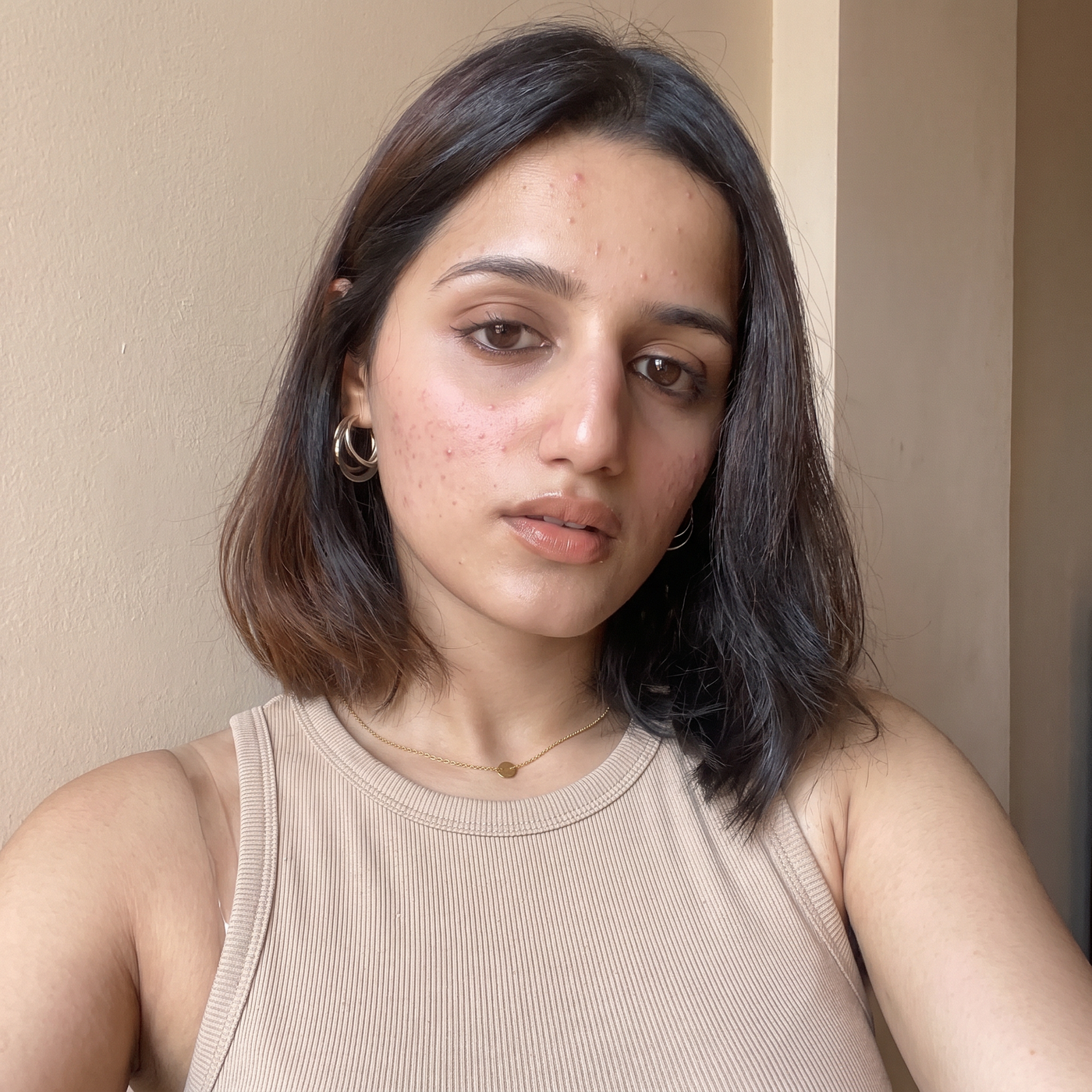 Before skincare result